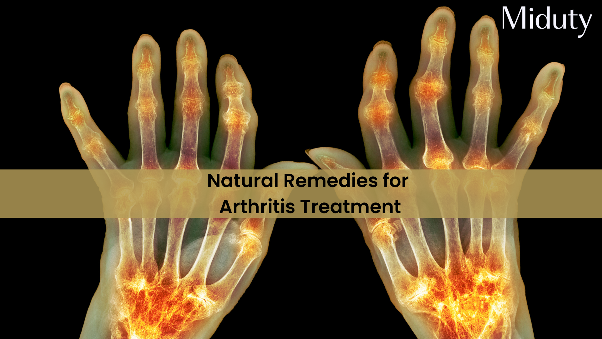 Top 10 Natural Remedies for Arthritis Treatment