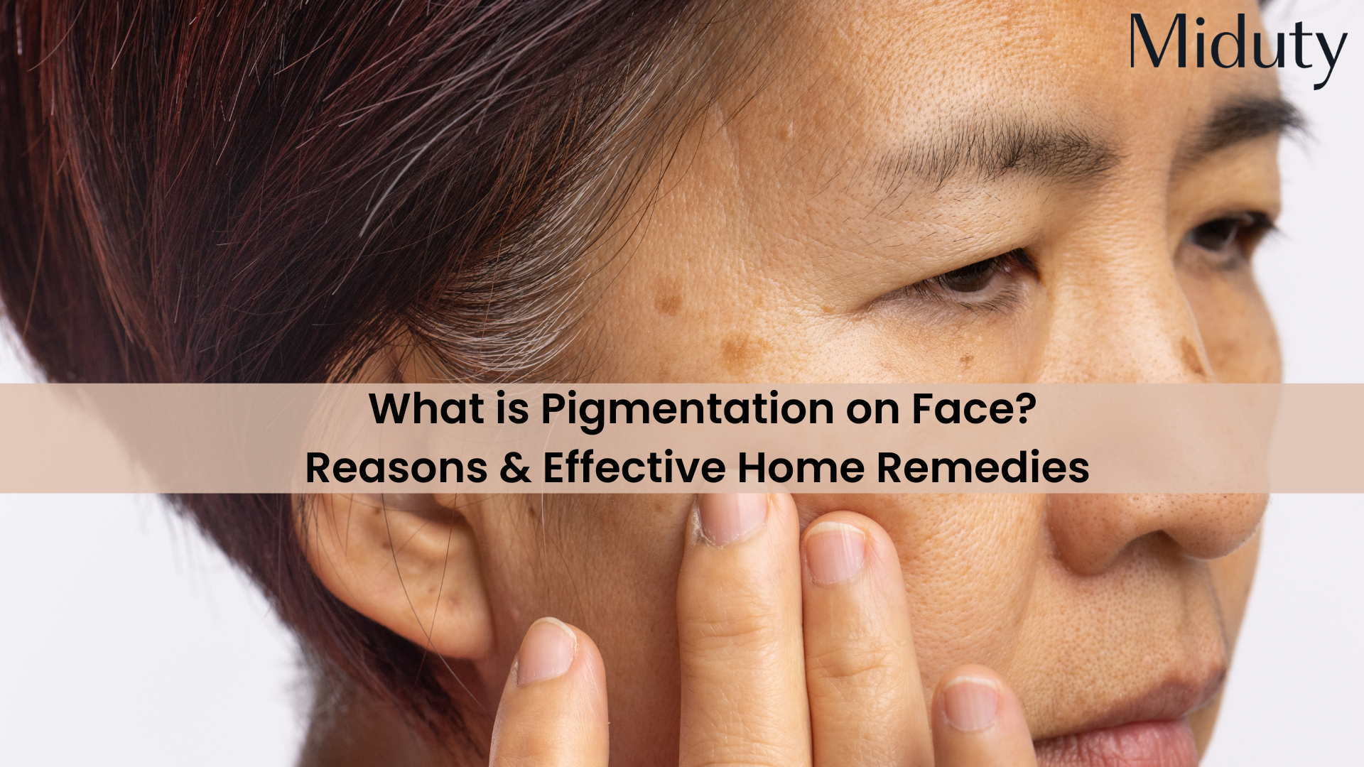 What is Pigmentation on Face?: Reasons & Effective Home Remedies