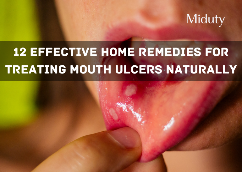 12 Effective Home Remedies For Treating Mouth Ulcers Naturally