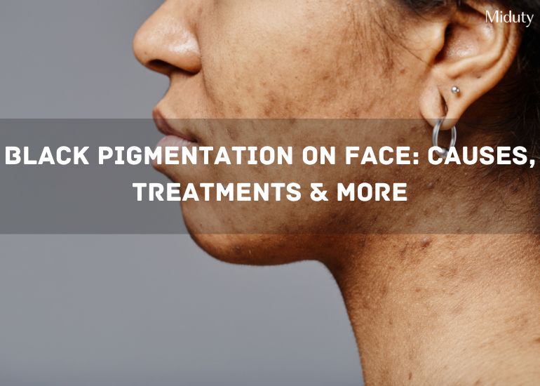 Black Pigmentation on Face: Causes, Treatments & More