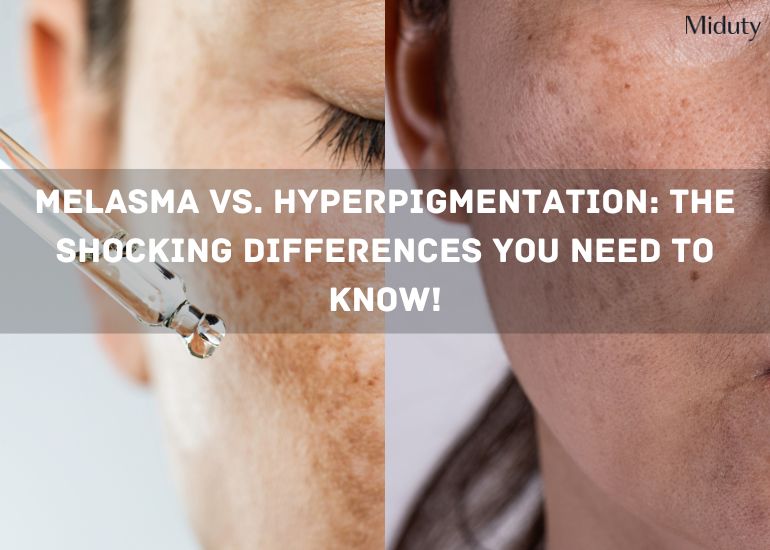 Melasma vs. Hyperpigmentation: The Shocking Differences You Need To Know!