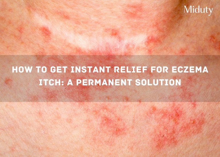 How to Get Instant Relief For Eczema Itch: A Permanent Solution