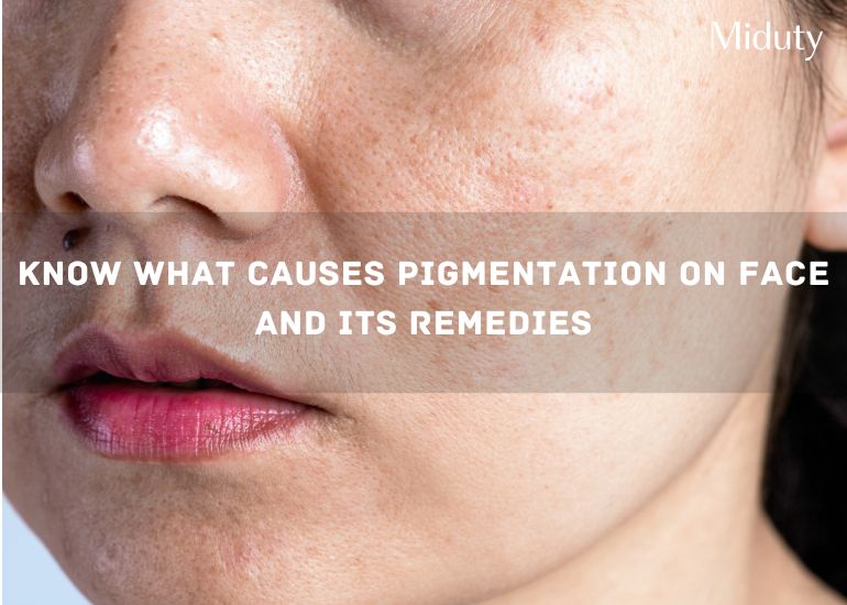 Know What Causes Pigmentation on Face and Its Remedies